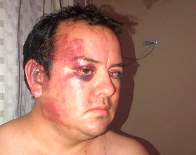 hombre_golpeado_cuarta