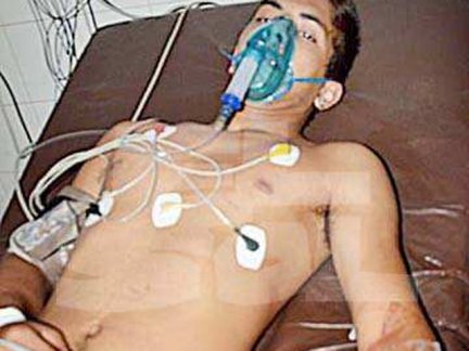 En Concordia, escopetazo policial a&nbsp;motociclistas