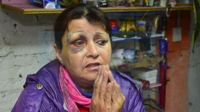 Se cayó por el mal estado de una vereda y denunciará a la Municipalidad