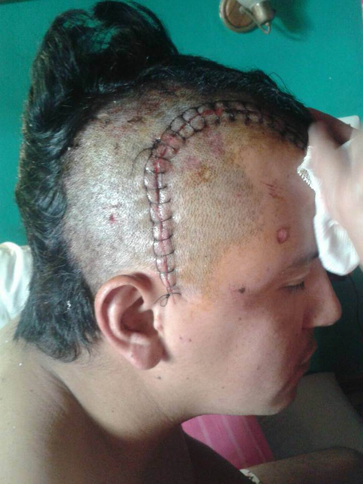 Ataque al presidente del club Peñarol: ya tienen prisión preventiva los&nbsp;detenidos